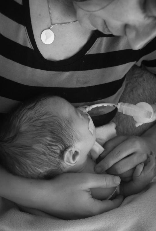 mama met zoontje met katheter