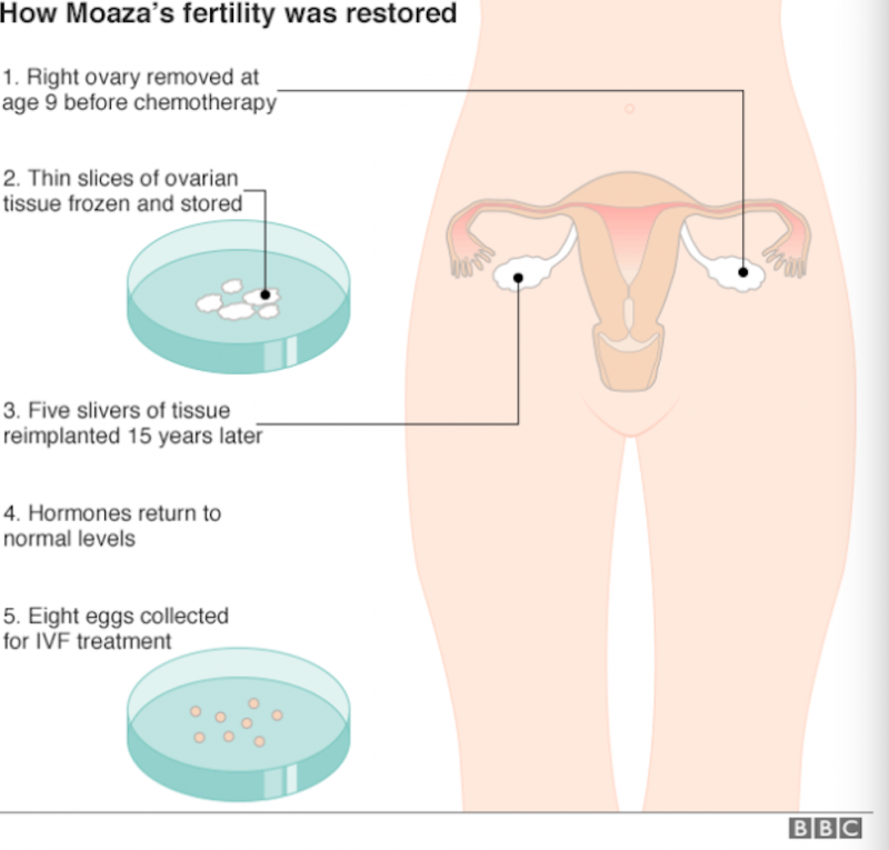 BBC News 