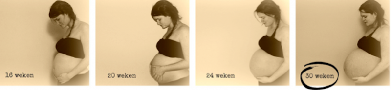 zwangere vrouw