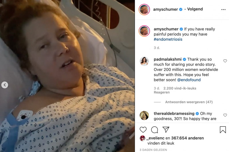 Amy Schumer na operatie voor endometriose