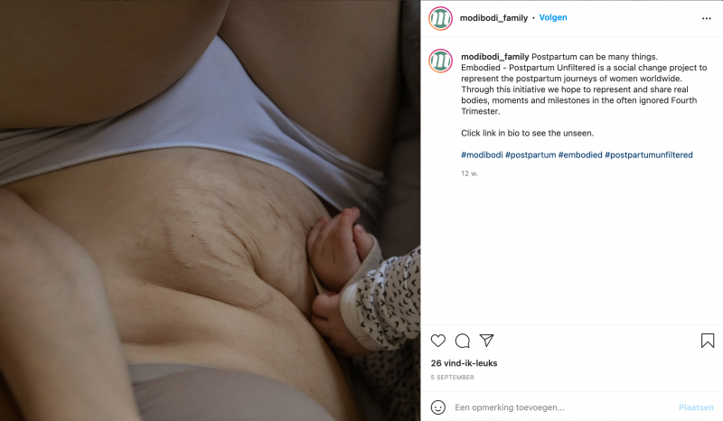 Postpartum lichaam