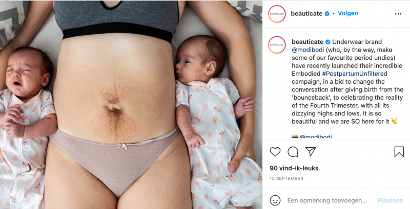 Postpartum lichaam