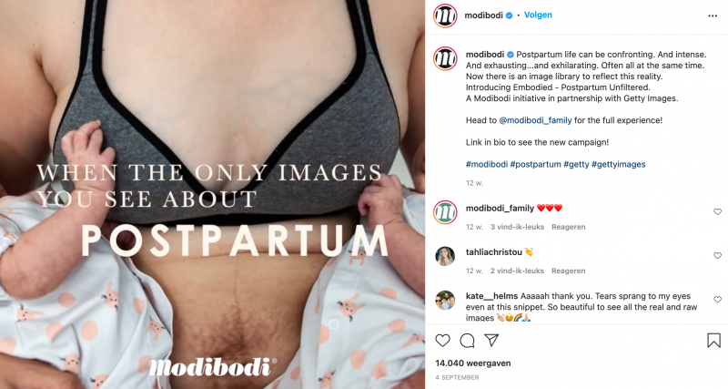 Postpartum lichaam